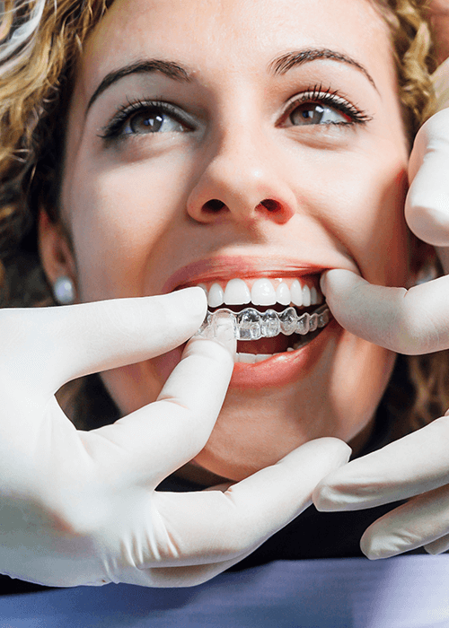 White-gloved hands placing an Invisalign aligner in a patient's mouth.
